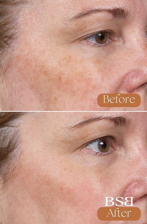 A before and after of a face after using Clear + Brilliant