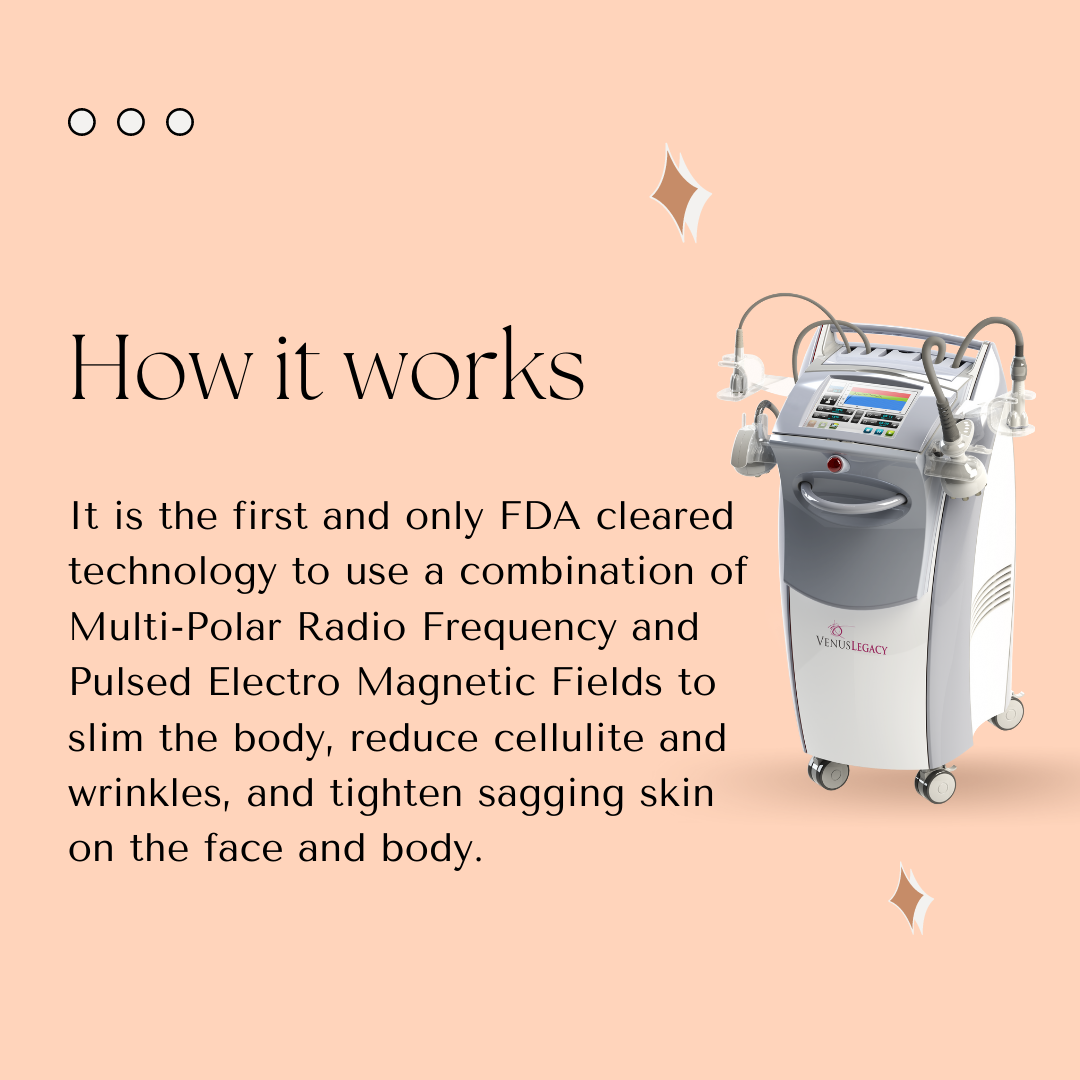 How the Venus Legacy Body Contouring Machine Works