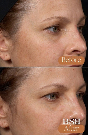 A before and after of a face after using Clear + Brilliant
