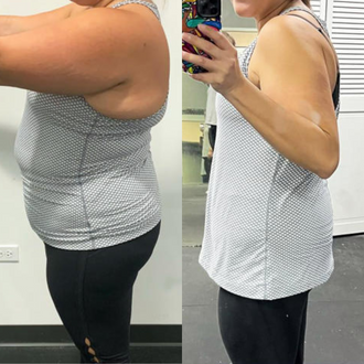 before and after weightloss treatment